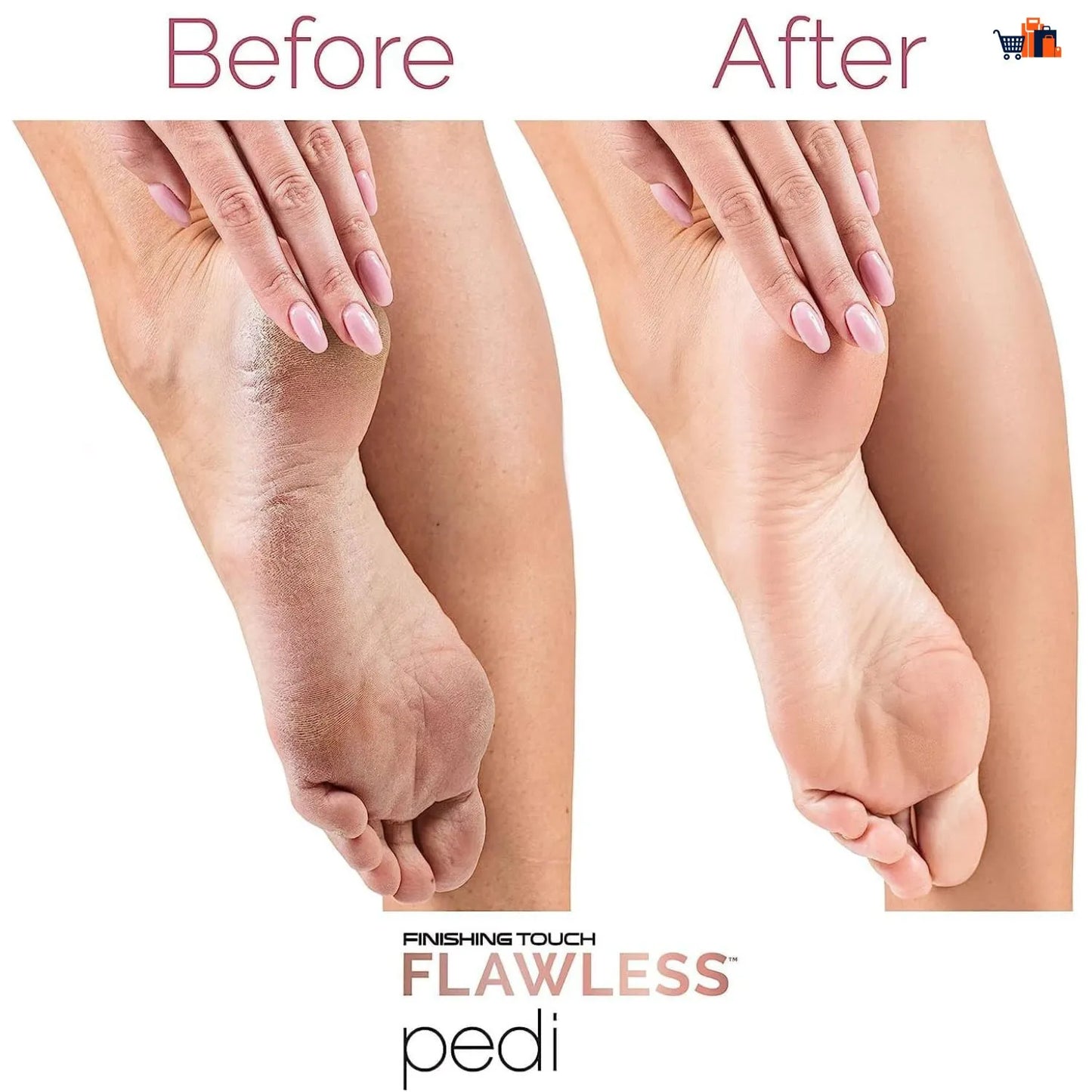 Electric Foot Callus Remover for Dead Skin